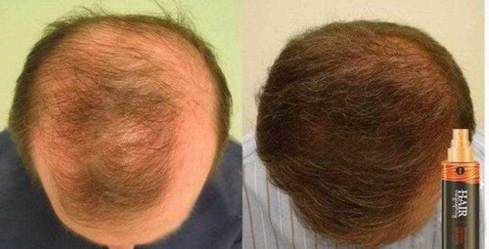 Маски против выпадение волос бровей
