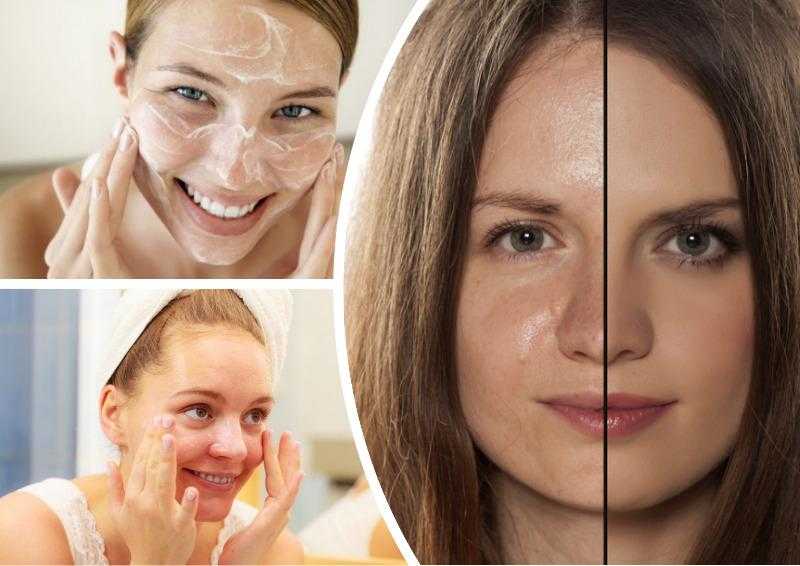 Причины жирного блеска кожи, как избавиться от жирного блеска кожи лица в домашних условиях