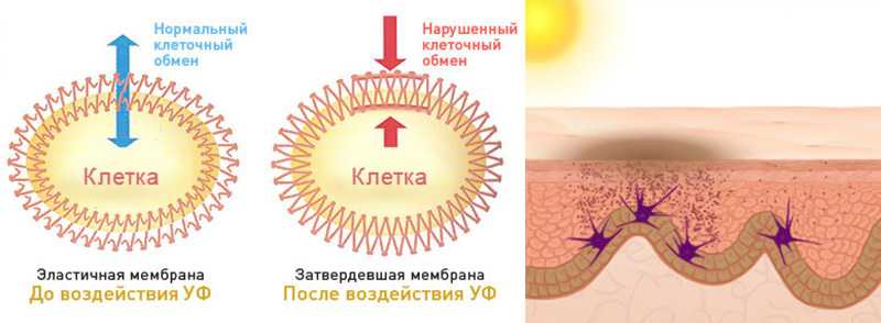 Радиация кожи. Воздействие УФ излучения на кожу. Влияние УФ лучей на кожу. Воздействие УФ лучей на кожу. Воздействие ультрафиолета на кожу.