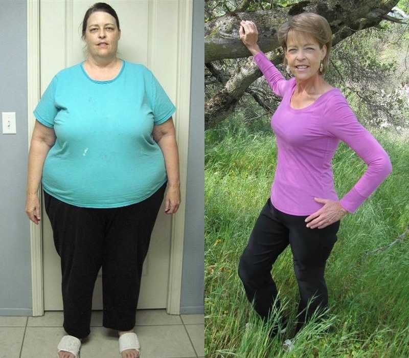 О похудении до и после: девушки после похудения, как изменилась их жизнь