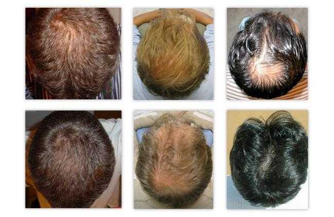 Спа для волос: что это такое, уход spa в салонах и домашних условиях, средства для процедуры восстановления, и можно ли делать беременным массаж головы