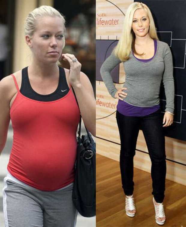 Невероятные истории похудения с фото до и после очень полных людей и их методы