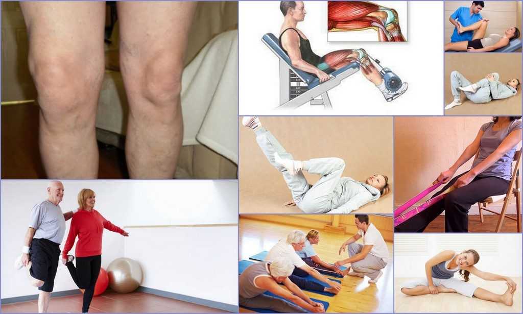 Упражнения для суставов после 60. Гонартроз ЛФК упражнения. Гонартроз коленного сустава ЛФК упражнения. Гимнастика при гонартрозе коленного сустава 1 степени. Остеоартроз коленного сустава упражнения.